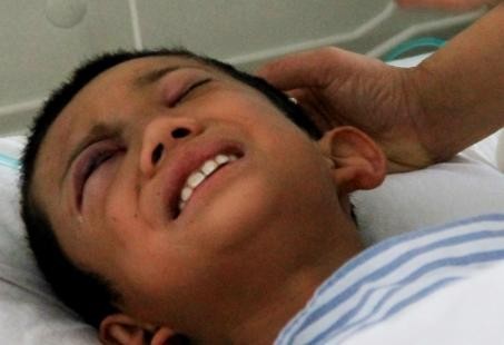 呼準(zhǔn)公路發(fā)生校車被撞事故 7名學(xué)生受傷 呼準(zhǔn)公路發(fā)生校車被撞事故 7名學(xué)生受傷