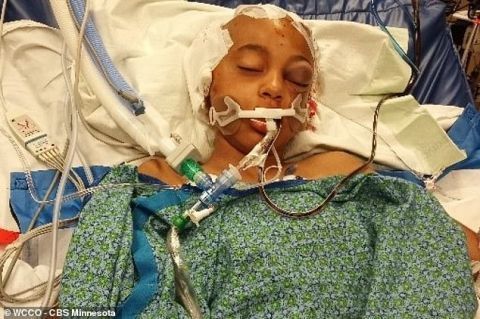 11歲的女孩在下校車時被撞 腦部已進行多次手術